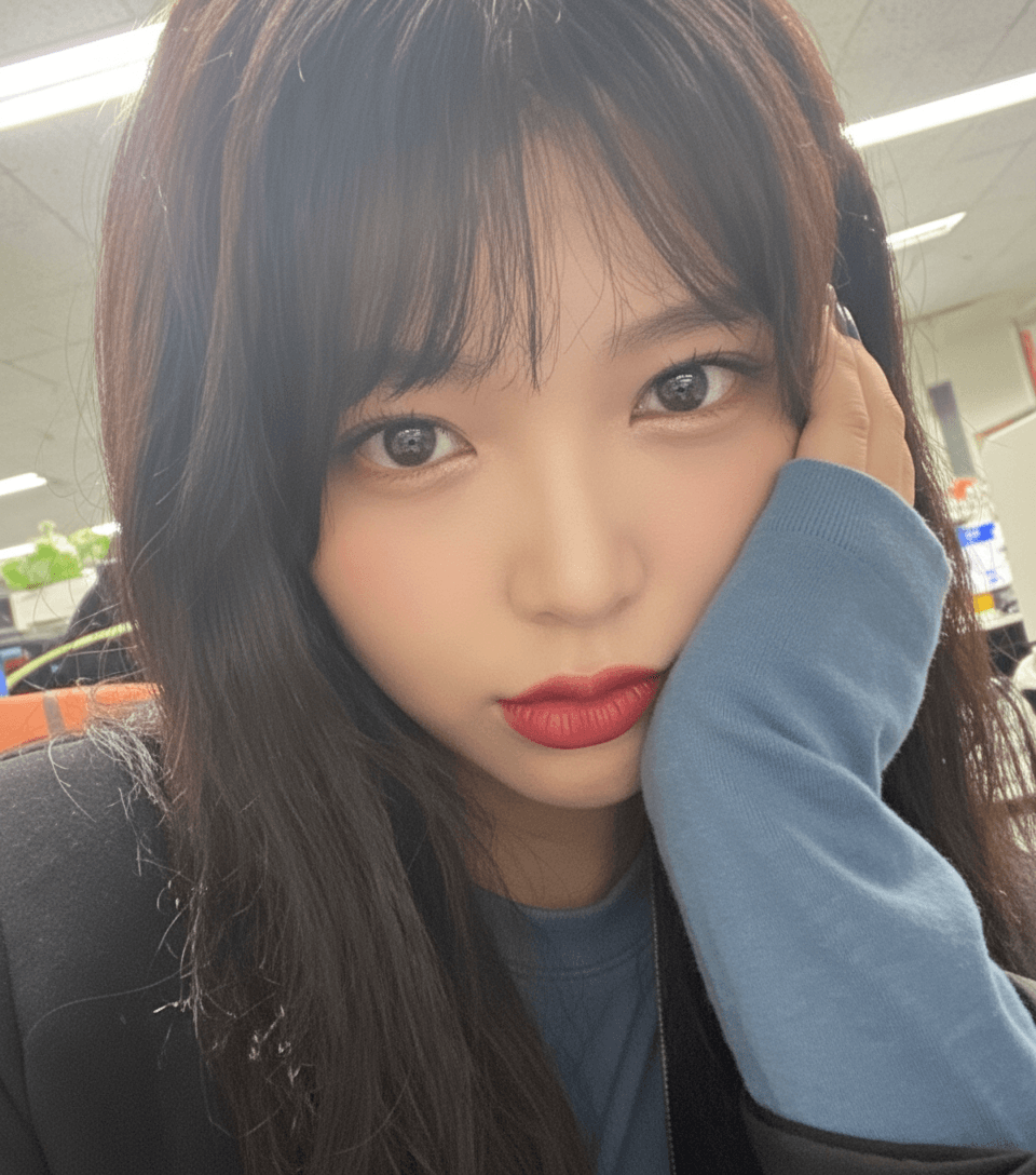 이마+관자놀이 PRP 지방이식 8주차. 푸석함이 줄어서 윤곽이 살아났어요