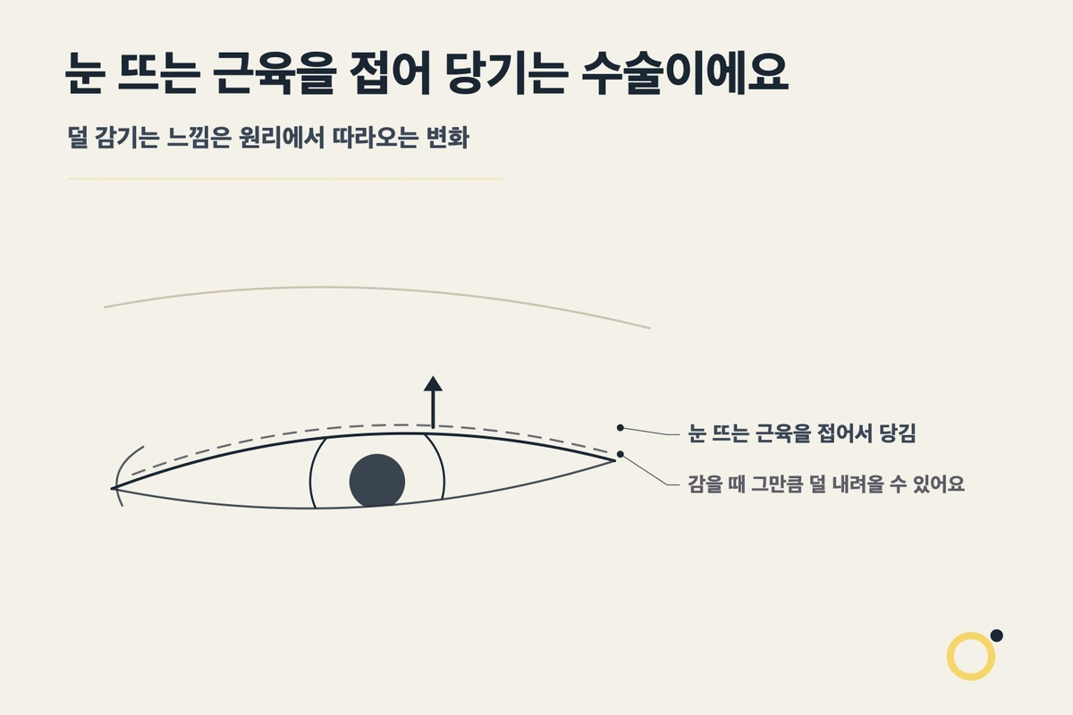 눈매교정 후 눈이 덜 감기는 것은 왜 생기나요? 설명 이미지
