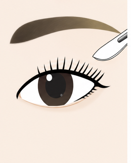 Procedure stage visual 01