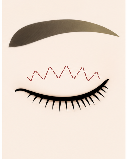Procedure stage visual 03
