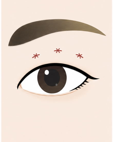 Procedure stage visual 03